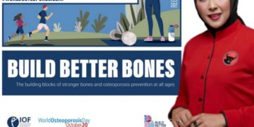 Hari Osteoporosis Sedunia, Dewi Juliani Ingatkan Untuk Menjaga Kesehatan Tulang