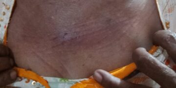 Kronologi Penganiayaan di Pematang Siantar: Fakta dan Pemberitaan yang Berbeda