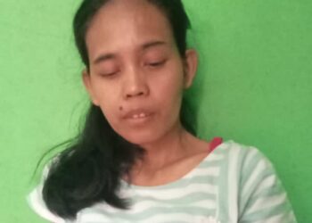 Terhalang Biaya, Warga Caringin Bogor Gagal Kontrol ke RS Cicendo, Kini Kehilangan Penglihatan