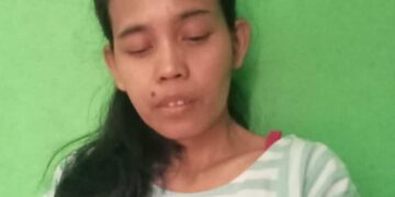Terhalang Biaya, Warga Caringin Bogor Gagal Kontrol ke RS Cicendo, Kini Kehilangan Penglihatan